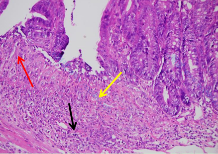 11f30485d30d2e3d6e6313fbe261e7a8 11f30485d30d2e3d6e6313fbe261e7a8