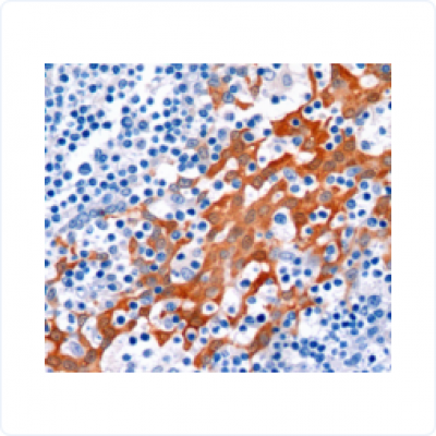 c984592bf27827b4c0a51f030391da3c_400x400_auto.jpg c984592bf27827b4c0a51f030391da3c_400x400_auto.jpg