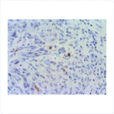 8ccd918e259ffc94bad3288dd4326d0f_400x400_auto.jpg 8ccd918e259ffc94bad3288dd4326d0f_400x400_auto.jpg