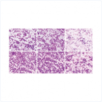 6a883b58bd59cf4d445deab8820f75b9_200x200_auto.jpg 6a883b58bd59cf4d445deab8820f75b9_200x200_auto.jpg