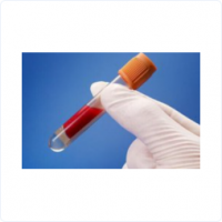 血常規(guī)/血生化