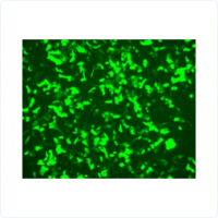 細(xì)胞轉(zhuǎn)染及穩(wěn)定表達(dá)細(xì)胞株構(gòu)建